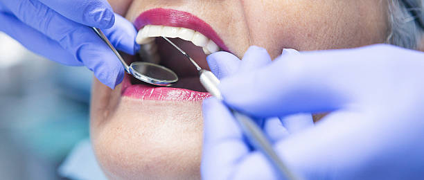 Best Broken or Chipped Tooth Repair in Argo, AL